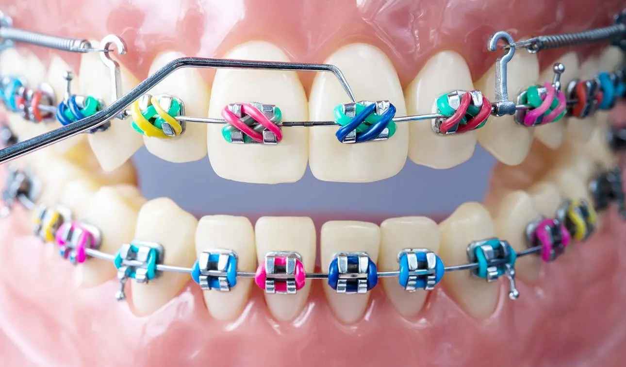 Orthodontics-Treatments